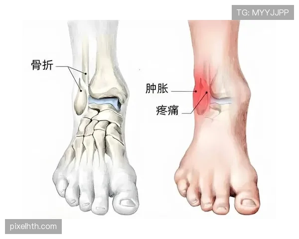 从争议视角解析违体犯规的判罚标准，如何准确认定球场上的危险动作？